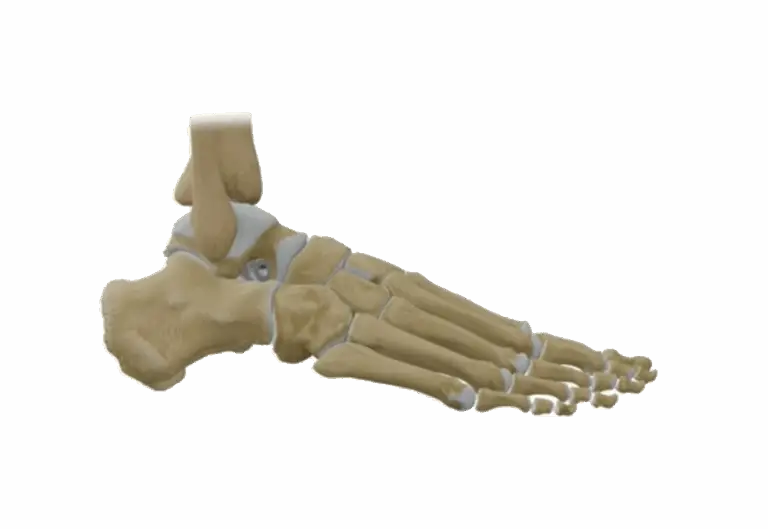 Position de la vis Jack'S dans le pied - Ortho Cape